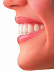 alignprofile