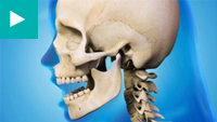 Teeth Whitening