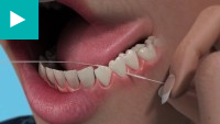 Teeth Whitening